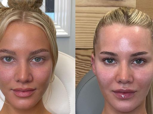 Love Island star Grace Jackson's cosmetic surgeon Dr Rosh reveals the secret to her looks