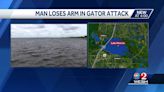 Man has arm amputated after gator attack at Seminole County lake