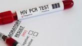 Here are the locations offering free HIV testing in Central Florida