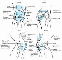 Image courtesy of teachmeorthopedics.info