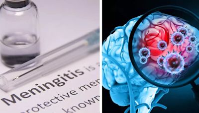 Are We Missing The Signs Of Meningitis Before It's Late? Expert Explains Why You Should Not Ignore This Fatal Disease