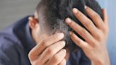 Targeting an Ancient Biological Stress Response Could Help Prevent Hair Loss