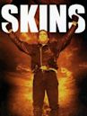 Skins (2002 film)