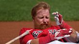 Red Sox infielder Justin Turner hit in face by pitch