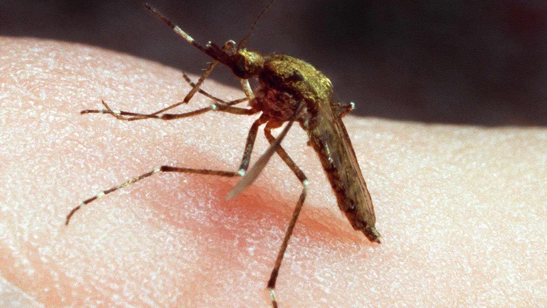 Mosquito bites are a pain. A doctor weighs in on how to ease the discomfort.