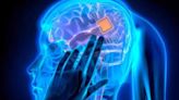 Musk's Neuralink says tiny wires of brain chip in first patient now stable - ET HealthWorld