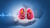 AstraZeneca’s trial of Imfinzi for lung cancer failed to meet primary endpoint