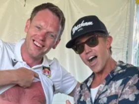 Welcome to Wrexham star shows off epic sunburn as he joins Rob McElhenney in USA