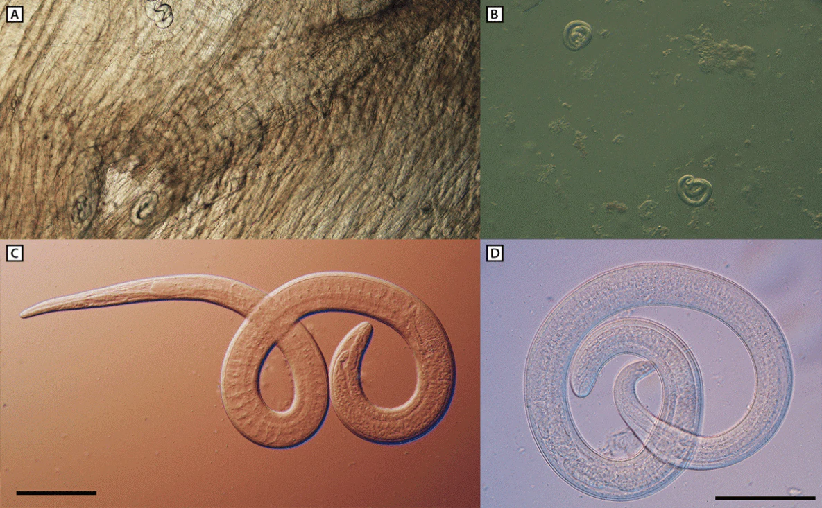 Family Members Infected With Parasitic Worms After Eating Undercooked Bear Meat at Reunion