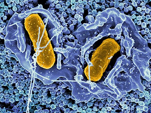 Rising antimicrobial resistance in certain Salmonella serovars isolated from retail chicken meat