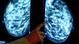 Preserving breast tissue outside of body will aid cancer research – study