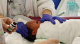 Tratar el frenillo lingual en recién nacidos mejora la lactancia materna