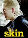 Skin – Hass war sein Ausweg