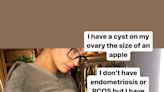 Hailey Baldwin Bieber Has an Ovarian Cyst the 'Size of an Apple'