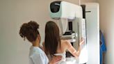 Mammograms should start at age 40, new guidelines recommend
