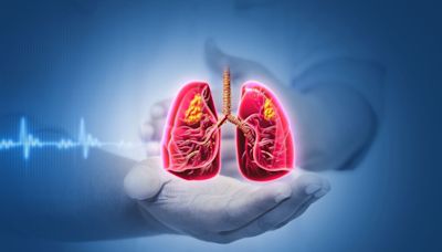 Roche’s Phase II/III NSCLC treatment trial fails to meet primary endpoints