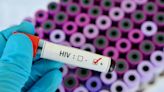 20 Countries With Highest Rates Of AIDS