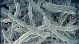 Organ Donor Whose Lungs Had Legionella Bacteria Might Have Caused the Deaths of Two Transplant Patients: CDC