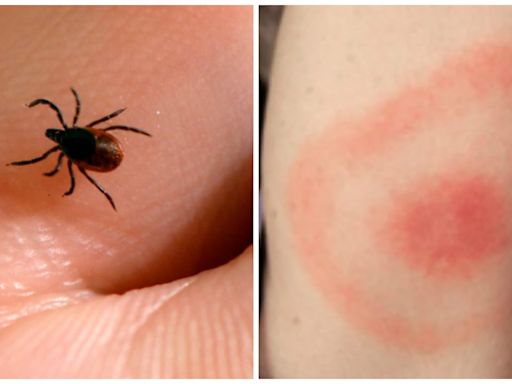 Ticks are back. Here's what experts say you should watch out for