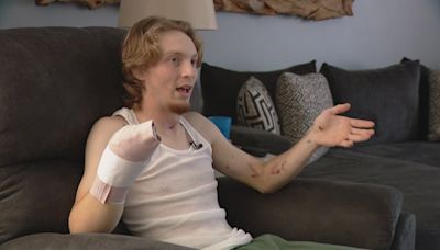 Washington teen loses hand in fireworks accident while protecting young kids