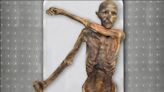 Ötzi, el hombre de las nieves, era calvo y predispuesto a la obesidad