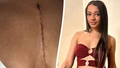 Beauty pageant contestant refuses to cover up her scar and says ‘it is who I am’