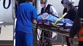Emergencias Pediátricas: Médicos extraen pito de corneta de juguete que menor tragó en Arequipa