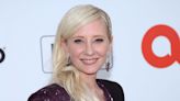 Anne Heche 'Legally Dead' After Suffering Severe Brain Injury As A Result Of Crash, Rep Says