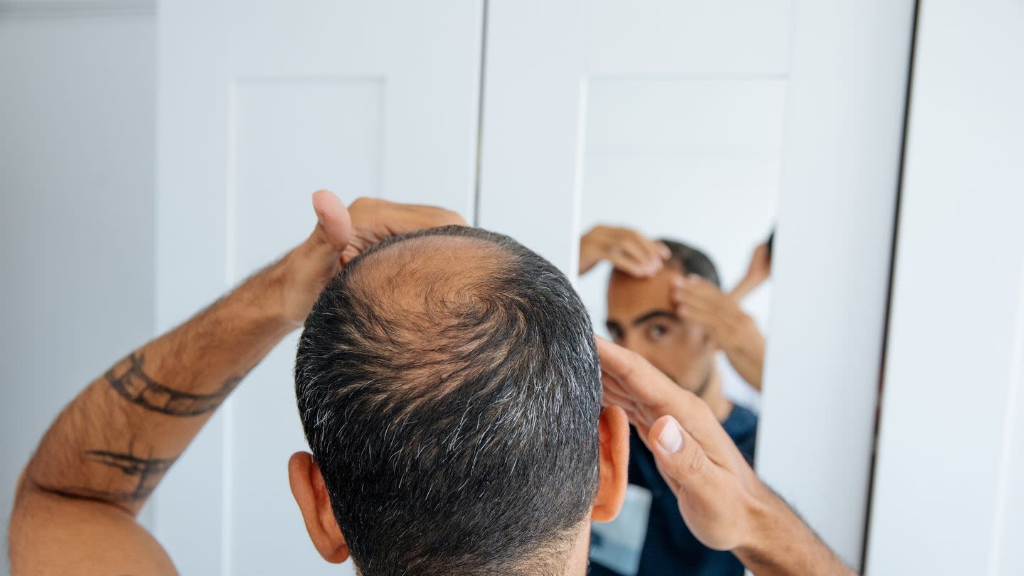 Does Finasteride Cause Side Effects? Doctors Explain.