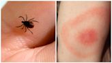 Ticks are back. Here's what experts say you should watch out for