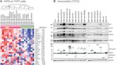 PKMYT1, a potential 'Achilles heel' of treatment resistant ER+ breast cancers with the poorest prognosis