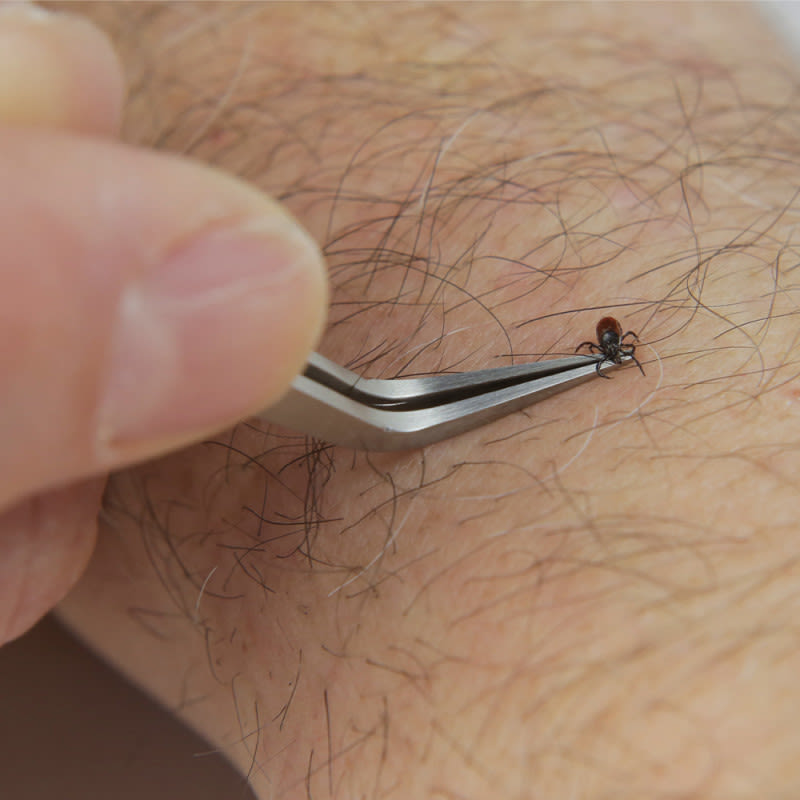 The Best Way to Remove a Tick? Use This Two-Sided Tool