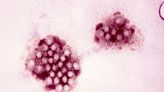 Docs: Norovirus, other stomach bugs still around Long Island