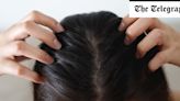 Why a balanced scalp microbiome is key to getting healthy, thick hair