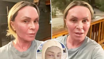 Tamra Judge shares update on ‘sanded and revarnished’ face after plastic surgery: ‘The worst of it is over’