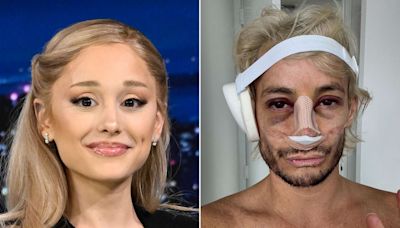 Ariana Grande Supports Brother Frankie’s Nose Job: ‘Perfect in All Ways, Always!!!!’