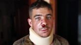 El accidente del soldado García en el Regimiento de Cerro Muriano donde murieron dos militares: 'Las órdenes de mi sargento me dejaron secuelas de por vida'