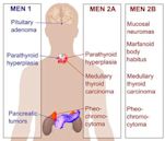 Multiple endokrine Neoplasie