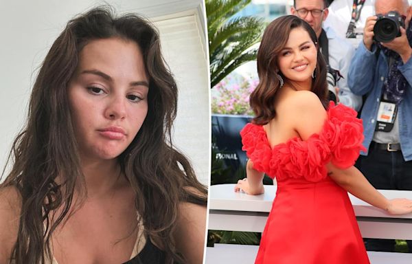 Selena Gomez reveals which cosmetic procedure she’s had done after fan speculation