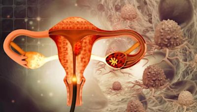 First-ever Ovarian Cancer Vaccine Could Wipe Out The Deadly Disease That Kills Thousands Of Women