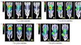 New chelating agent reduces toxicity in prostate-specific membrane antigen radiopharmaceutical therapy