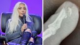 Kim Kardashian Struggles With Finger Injury 'More Painful Than Childbirth' in New 'Kardashians' Teaser