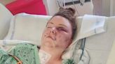 Good Samaritans Save Woman Stabbed, Set On Fire By Husband