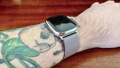 Apple Watch issues force one user to undergo tattoo removal