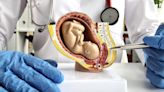 El útero artificial para salvar la vida de bebés prematuros (y la preocupación ética que despierta)