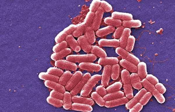 E. coli outbreak: 86 people taken to hospital but cases are slowing down