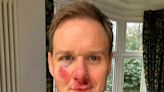 Dan Walker issues warning to cyclists: ‘My helmet saved my life’