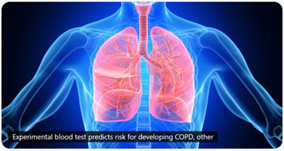 NIH Reports Experimental Blood Test Predicts Risk for Developing COPD, Other Severe Respiratory Diseases