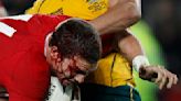 NFL-style lawsuit and brain-injury concerns hang over Rugby World Cup