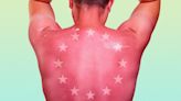 European sunscreens offer better protection, dermatologist says